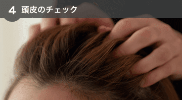頭皮のチェック